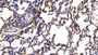 DAB staining on IHC-P; Samples: Rat Lung Tissue;  Primary Ab: 20µg/ml Rabbit Anti-Rat TM Antibody Se