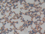 DAB staining on IHC-P; Samples: Mouse Lung Tissue;  Primary Ab: 10µg/ml Rabbit Anti-Mouse TM Antibod