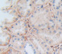 Thrombomodulin (Tm) Polyclonal Antibody, Cat#CAU27750