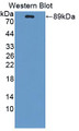 Western Blot; Sample: Recombinant tPA, Porcine.