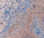 Cytokeratin 14 (Ck14) Polyclonal Antibody, Cat#CAU27766