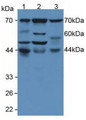 Western Blot; Sample: Lane1: Human MCF7 Cells; Lane2: Human Hela Cells; Lane3: Human Jurkat Cells.