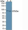 Western Blot; Sample: Lane1: Mouse Brain Tissue; Lane2: Rat Brain Tissue.