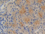 DAB staining on fromalin fixed paraffin- embedded spermaduct tissue)