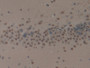 DAB staining on IHC-P; Samples: Rat Brain Tissue; Primary Ab: 10µg/ml Rabbit Anti-Rat KRT1 Antibody Second Ab: 2µg/mL HRP-Linked Caprine Anti-Rabbit IgG Polyclonal Antibody