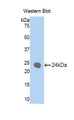 Western Blot; Sample: Recombinant protein.