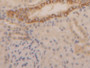 DAB staining on IHC-P; Samples: Rat Kidney Tissue; Primary Ab: 20µg/ml Rabbit Anti-Rat KRT1 Antibody Second Ab: 2µg/mL HRP-Linked Caprine Anti-Rabbit IgG Polyclonal Antibody