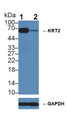 Knockout Varification: &lt;br/&gt;Lane 1: Wild-type A431 cell lysate; &lt;br/&gt;Lane 2: KRT2 knockout A431 cell lysate; &lt;br/&gt;Predicted MW: 69kDa &lt;br/&gt;Observed MW: 69kDa&lt;br/&gt;Primary Ab: 1µg/ml Rabbit Anti-Rat KRT2 Antibody&lt;br/&gt;Second Ab: 0.2µg/mL HRP-Linked Caprine Anti-Rabbit IgG Polyclonal Antibody&lt;br/&gt;