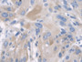 DAB staining on IHC-P; Samples: Human Esophagus Tissue; Primary Ab: 20µg/ml Rabbit Anti-Human KRT2 Antibody Second Ab: 2µg/mL HRP-Linked Caprine Anti-Rabbit IgG Polyclonal Antibody