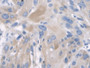 DAB staining on IHC-P; Samples: Human Esophagus)