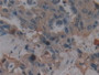 DAB staining on fromalin fixed paraffin- embedded stomach tissue)
