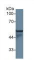 Western Blot; Sample: Human A431 cell lysate; Primary Ab: 1µg/ml Rabbit Anti-Rat KRT4 Antibody Second Ab: 0.2µg/mL HRP-Linked Caprine Anti-Rabbit IgG Polyclonal Antibody