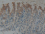 DAB staining on IHC-P; Samples: Rat Stomach Tissue; Primary Ab: 10µg/ml Rabbit Anti-Rat KRT5 Antibody Second Ab: 2µg/mL HRP-Linked Caprine Anti-Rabbit IgG Polyclonal Antibody