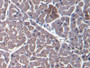 DAB staining on IHC-P; Samples: Bovine Cardiac Muscle Tissue)