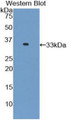 Western Blot; Sample: Recombinant protein.