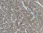 DAB staining on IHC-P; Samples: Porcine Heart Tissue; Primary Ab: 20µg/ml Rabbit Anti-Porcine TNNI3 Antibody Second Ab: 2µg/mL HRP-Linked Caprine Anti-Rabbit IgG Polyclonal Antibody