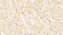 DAB staining on IHC-P; Samples: Mouse Cardiac Muscle Tissue;  Primary Ab: 5μg/ml Rabbit Anti-Mouse TNNI3 Antibody Second Ab: 2µg/mL HRP-Linked Caprine Anti-Rabbit IgG Polyclonal Antibody 
