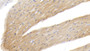 DAB staining on IHC-P; Samples: Canine Cardiac Muscle Tissue;  Primary Ab: 20μg/ml Rabbit Anti-Canine TNNI3 Antibody Second Ab: 2µg/mL HRP-Linked Caprine Anti-Rabbit IgG Polyclonal Antibody 
