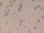 DAB staining on IHC-P; Samples: Human Brain Tissue; Primary Ab: 10µg/ml Rabbit Anti-Human SDF2 Antibody Second Ab: 2µg/mL HRP-Linked Caprine Anti-Rabbit IgG Polyclonal Antibody