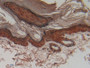 DAB staining on IHC-P; Samples: Rat Skin Tissue; Primary Ab: 10µg/ml Rabbit Anti-Rat CSTA Antibody Second Ab: 2µg/mL HRP-Linked Caprine Anti-Rabbit IgG Polyclonal Antibody