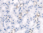 DAB staining on IHC-P; Samples: Rat Kidney Tissue)