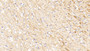 DAB staining on fromalin fixed paraffin-embedded Testis tissue)