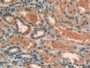 DAB staining on IHC-P; Samples: Human Kidney Tissue; Primary Ab: 10µg/ml Rabbit Anti-Human LIPG Antibody Second Ab: 2µg/mL HRP-Linked Caprine Anti-Rabbit IgG Polyclonal Antibody