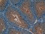 DAB staining on IHC-P; Samples: Mouse Testis Tissue; Primary Ab: 10µg/ml Rabbit Anti-Mouse DAF Antibody Second Ab: 2µg/mL HRP-Linked Caprine Anti-Rabbit IgG Polyclonal Antibody