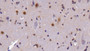 DAB staining on IHC-P; Sample: Mouse Spinal cord Tissue; Primary Ab: 20ug/ml Rabbit Anti-Mouse CASP14 Antibody Second Ab: 2µg/mL HRP-Linked Caprine Anti-Rabbit IgG Polyclonal Antibody