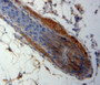 DAB staining on fromalin fixed paraffin-embedded skin tissue)