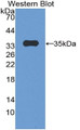 Western Blot; Sample: Recombinant protein.