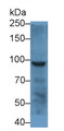 Western Blot; Sample: Cavia Salivary gland lysate; Primary Ab: 5μg/ml Rabbit Anti-Human PKP2 Antibody; Second Ab: 0.2µg/mL HRP-Linked Caprine Anti-Rabbit IgG Polyclonal Antibody;