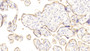 DAB staining on IHC-P; Samples: Human Placenta Tissue;  Primary Ab: 20μg/ml Rabbit Anti-Human DSG3 Antibody Second Ab: 2µg/mL HRP-Linked Caprine Anti-Rabbit IgG Polyclonal Antibody 