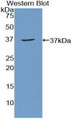 Western Blot; Sample: Recombinant protein.