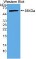 Western Blot; Sample: Recombinant protein.
