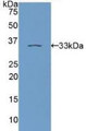 Western Blot; Sample: Recombinant PKCe, Human.