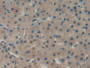 DAB staining on IHC-P; Samples: Human Liver Tissue.