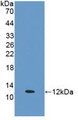 Western Blot; Sample: Recombinant ERb, Human.