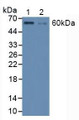 Western Blot; Sample: Lane1: Human HepG2 Cells; Lane2: Human K562 Cells.