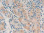 DAB staining on IHC-P; Samples: Human Stomach Tissue; Primary Ab: 20µg/ml Rabbit Anti-Human HSF1 Antibody Second Ab: 2µg/mL HRP-Linked Caprine Anti-Rabbit IgG Polyclonal Antibody