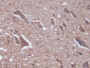 DAB staining on IHC-P; Samples: Rat Spinal cord Tissue; Primary Ab: 20µg/ml Rabbit Anti-Rat PKCd Antibody Second Ab: 2µg/mL HRP-Linked Caprine Anti-Rabbit IgG Polyclonal Antibody