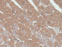 DAB staining on IHC-P; Samples: Rat Heart Tissue; Primary Ab: 20µg/ml Rabbit Anti-Rat PKCd Antibody Second Ab: 2µg/mL HRP-Linked Caprine Anti-Rabbit IgG Polyclonal Antibody