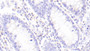 DAB staining on IHC-P; Samples: Human Colon Tissue;  Primary Ab: 20μg/ml Rabbit Anti-Human GZMM Antibody Second Ab: 2µg/mL HRP-Linked Caprine Anti-Rabbit IgG Polyclonal Antibody 