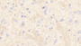 DAB staining on fromalin fixed paraffin-embedded Brain tissue)