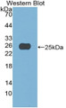 Western Blot; Sample: Recombinant ACF, Human.