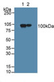 Western Blot; Sample: Lane1: Rat Brain Tissue; Lane2: Mouse Brain Tissue.