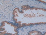 Figure. DAB staining on IHC-P; Samples: Human Prostate Gland Tissue.