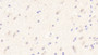 DAB staining on IHC-P; Samples: Human Cerebrum Tissue;  Primary Ab: 20μg/ml Rabbit Anti-Human MOG Antibody Second Ab: 2µg/mL HRP-Linked Caprine Anti-Rabbit IgG Polyclonal Antibody 