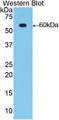 Western Blot; Sample: Recombinant protein.