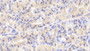 DAB staining on fromalin fixed paraffin-embedded Liver tissue)